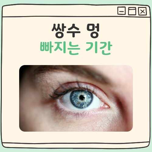 쌍수 멍 빠지는 기간 대표 이미지