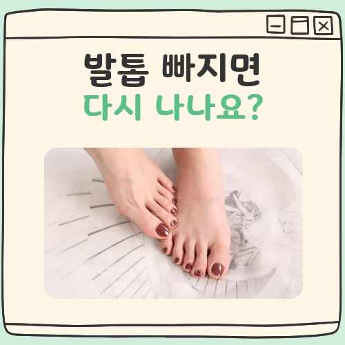 발톱 빠지면 다시 나나요 대표 이미지